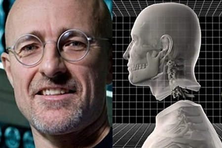 全球首例换头手术将会使用虚拟现实技术